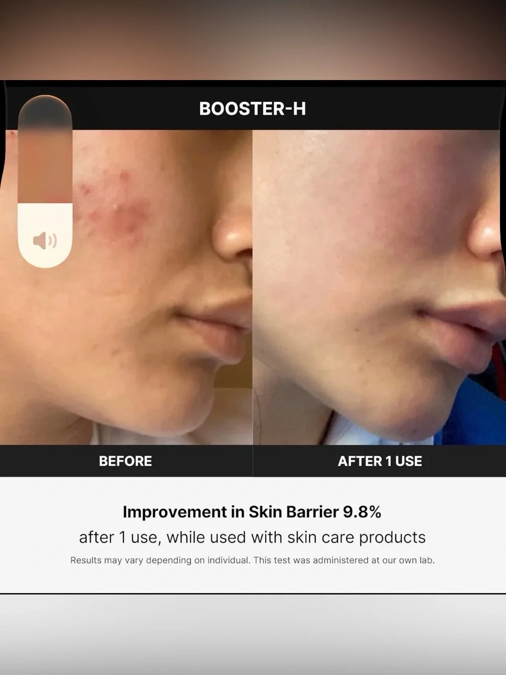 MediCube AGE-R Booster H - Korean Skincare Tool
